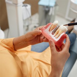 Dentist pointing to dental implant model held by patient